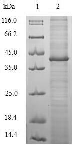 (Tris-Glycine gel) Discontinuous SDS-PAGE (reduced) with 5% enrichment gel and 15% separation gel.